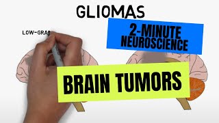 2Minute Neuroscience Brain tumors [upl. by Publias236]