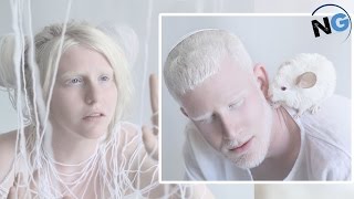 Photo Gallery Highlights The Beauty Of Albino People And It’s Truly Mesmerizing [upl. by Cirdes]