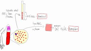 Anemia Basic lab tests  hematocrit hemoglobin reticulocyte MCV morphology [upl. by Muriel]