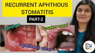 RECURRENT APHTHOUS STOMATITIS RAS PART 2 [upl. by Letniuq]