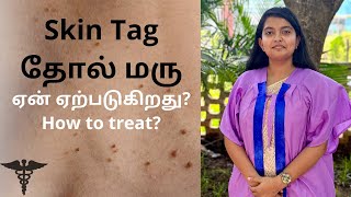 தோல் மரு SKIN TAG  ஏன் ஏற்படுகிறது காரணம் என்ன How to treat  EXPLAINED in Tamil [upl. by Negiam]