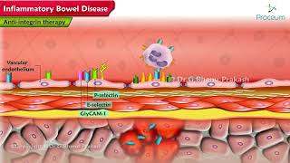 Inflammatory Bowel Disease Pharmacology Lectures [upl. by Meridel64]