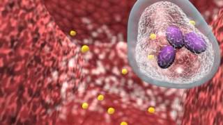 Bacterial infection and host response [upl. by Agnes]