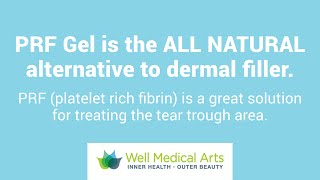 PRF gel is the all natural dermal filler available at Well Medical Arts in Seattle [upl. by Waldack]