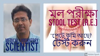 মল পরীক্ষা Stool Test Stool Analysisপায়খানা পরীক্ষা Mol Pariksha [upl. by Sidoeht983]