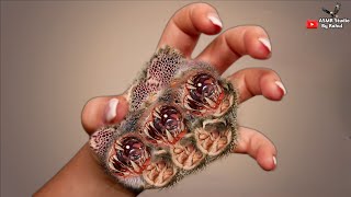 ASMR Remove maggot dog tick  Maggot  spider lice eyeball from Hand  Asmr Hand Treatment Clean [upl. by Stevena]