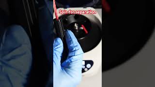 Blood test procedure Hematocrit diy health fitness lifestyle [upl. by Jabez632]