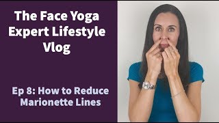 Ep 8 Vlog  How to Reduce Marionette Lines [upl. by Rahal]