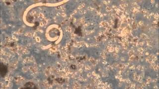 Video clip 1 of Angiostrongylus cantonensis in solution with residual slug tissue [upl. by Thurmond]