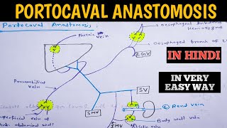 Portocaval Anastomosis  Caput medusae  Oesophageal varices  Portacaval anastomoses in easy way [upl. by Airyt]