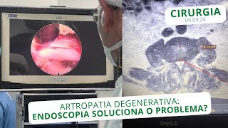 Artropatia Degenerativa Endoscopia soluciona o problema  040324 [upl. by Dorrahs]