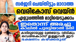 സർജറി ചെയ്തിട്ടും വെരികോസ് മാറുന്നില്ലേ ഈ ഇല കാലിൽ അരച്ചുപുരട്ടിയാൽ രക്തയോട്ടം വർധിക്കും  vericose [upl. by Ainolloppa]