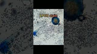 Aspergillus niger on SDA and LPCB staining [upl. by Enoid629]