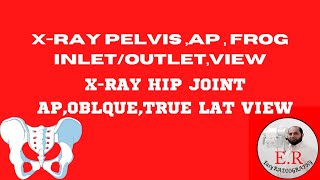 How to do Xray Pelvis Hip joint PELVISAPLAT FrogHIP JOINT In UrduHindieasy radiography [upl. by Hayton995]