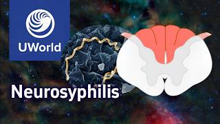 Syphilis Neurosyphilis amp Tabes Dorsalis SymptomsPathophysiology UWorld Step 1 [upl. by Intyre]