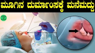 Sutra Neti for Beginners in Kannada  Nasal Polyp Removal in Kannada  What is Nasal Polyp Kannada [upl. by Chauncey444]