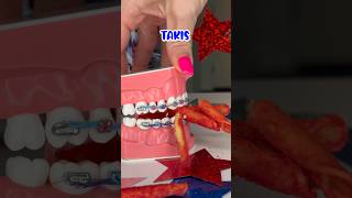 Chips you CANT eat with BRACES ON 👀 Orthodontist Reacts to Cheetos Doritos Takis Crunchy Food ASMR [upl. by Eterg]