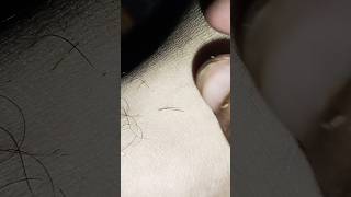 two hair removal barbersurgion barbershop hairremoval [upl. by Yasmeen]