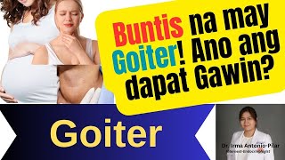 Buntis na May Goiter [upl. by Aneerhs]