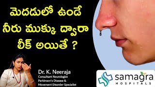 Understanding Brain Fluid Leak CSF Rhinorrhea Causes Symptoms amp Treatment  Dr Neeraja [upl. by Madeleine]