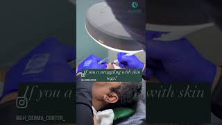 Skin Tag Removal ghdermacenterhospital2196 [upl. by Yenreit]