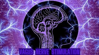 VAGUS NERVE STIMULATION IMPROVES  BRAIN AND CHANNEL CONNECTION HEAL [upl. by Maier]