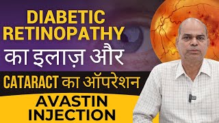 Diabetic Retinopathy Treatment With Avastin Injection इंजेक्शन से किये डायबिटीज रेटिनोपैथी का इलाज [upl. by Hedi]