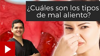 Episodio 5 ¿Cuáles son los tipos de mal aliento Halitosis [upl. by Enna]