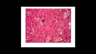 Pancreatic Acinar Cell Lab [upl. by Christalle845]