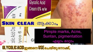 How to use glycolic Acid creamGlyco 6ww Review in malayalam [upl. by Namurt]