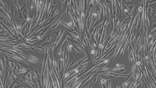 Differentiation of MM14 skeletal muscle cells [upl. by Adnarb]