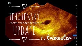 Tehotenský update za 1 trimester [upl. by Negah]