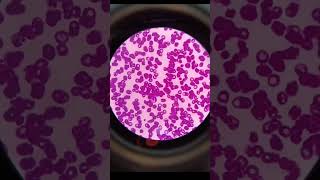 Microscopy hematology dlc tlc [upl. by Threlkeld]