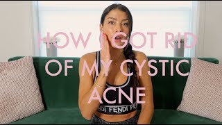 Clear Skin from within How i cured my Cystic Acne and how you can too [upl. by Dranal]