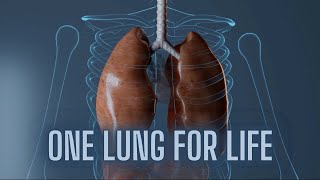 Living with One Lung What to Expect [upl. by Vi]