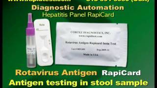 Rotavirus Antigen Rapid Test [upl. by Isdnyl358]