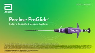 US Small Hole ProGlide™ Deployment Video [upl. by Pollak]