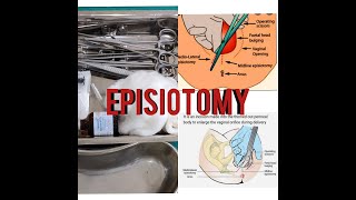 EPISIOTOMY EPISIOTOMY TRAYINSTRUMENTEASY EXPLANATIONSUSES [upl. by Ylak]