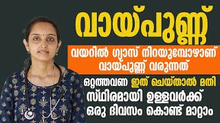 വായ്പുണ്ണ് പൂർണമായും മാറ്റാൻ തൈര് കൊണ്ട് ഇങ്ങനെ ചെയ്യൂ  vaypunn maran [upl. by Leah]