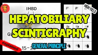 Hebatobiliary Scintigraphy Explained HIDA scan [upl. by Bannerman]