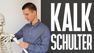 Schulterschmerzen durch KALKSCHULTER Tendinosis calcarea  Symptome Entstehung Therapie [upl. by Sly]