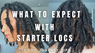 WHAT TO EXPECT IN FIRST YEAR OF YOUR LOC JOURNEY  15 tips for Starter Locs [upl. by Aggarwal664]