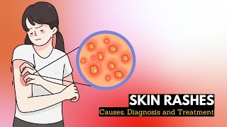 Skin Rash Causes Signs and Symptoms Diagnosis and Treatment [upl. by Eilerua]