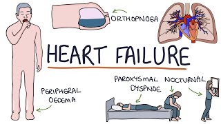 Understanding Heart Failure Visual Explanation for Students [upl. by Susi]