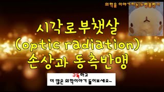 시각로부챗살optic radiation  반대쪽 동측 반맹contralateral homonymous hemianopsia Meyers loop [upl. by Argus]