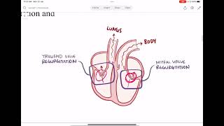 5 Cardiomyopathy [upl. by Ilellan]