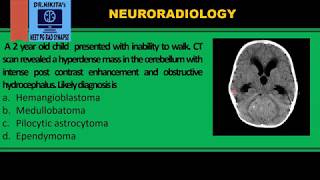 Medulloblastoma II CTMRI findings [upl. by Miche]