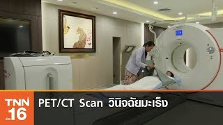 PETCT Scan นวัตกรรมเพิ่มความแม่นยำวินิจฉัยมะเร็ง [upl. by Inar]