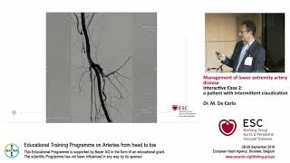 M De Carlo Interactive Case 2 a patient with intermittent claudication [upl. by Odla]