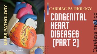 CARDIAC PATHOLOGY CONGENITAL HEART DISEASES part2 lecture15 pathology robbins pathoma mbbs [upl. by Old]